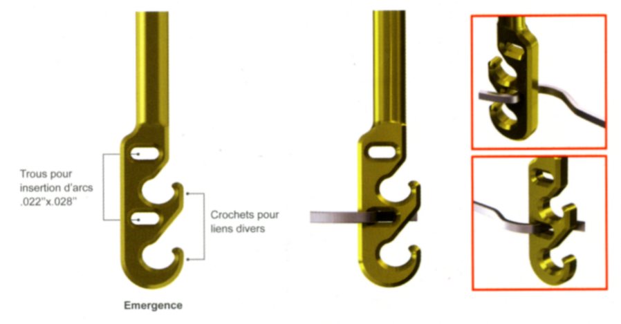 Tête équipée de 2 crochets, utilisatbles dans les systèmes de traction directe Alésages oblongs, permattant l'utilisation d’auxiliaires à insertion directe