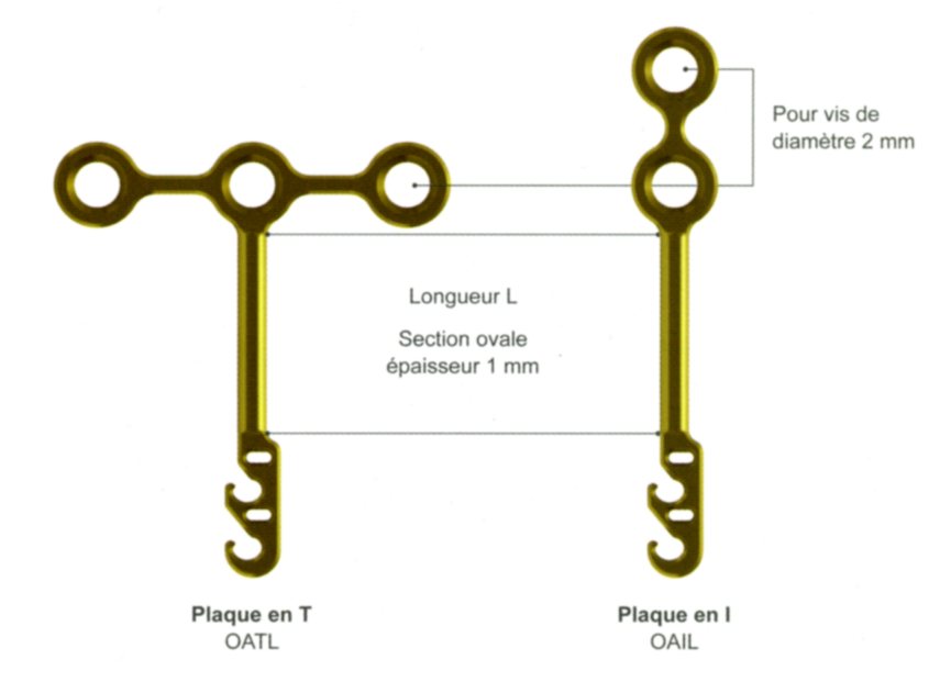 2 formes de plaques en titane de grade 2, conformables selon le site de pose, en longueur 5, 7 10 et 12mm