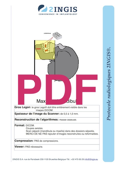 2IngisProtocoleRadio